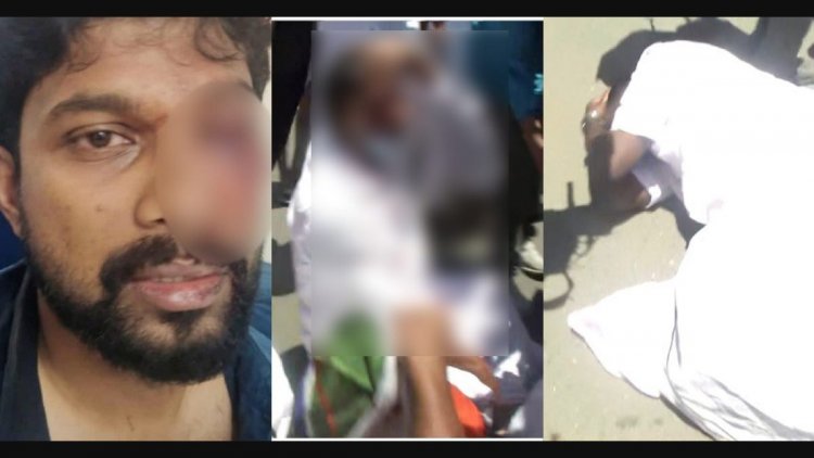 തൊടുപുഴ ലാത്തിചാര്‍ജ്; കോണ്‍ഗ്രസ പ്രവര്‍ത്തകന്റെ കാഴ്ച്ച നഷ്ടപെടുമെന്ന് ആശങ്ക