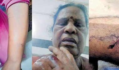 തെരുവുനായകള്‍ക്ക് ഭക്ഷണം നല്‍കുന്നതിനിടയില്‍ സീരിയല്‍ നടിക്ക് തെരുവ് നായയുടെ കടിയേറ്റു.