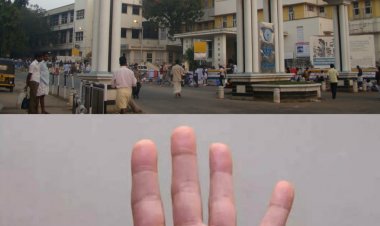 ഭർത്താവിന്റെ വെട്ടേറ്റ് അറ്റുപോയ യുവതിയുടെ കൈപ്പത്തി തുന്നിച്ചേര്‍ത്ത്  തിരുവനന്തപുരം മെഡിക്കൽ കോളേജ്